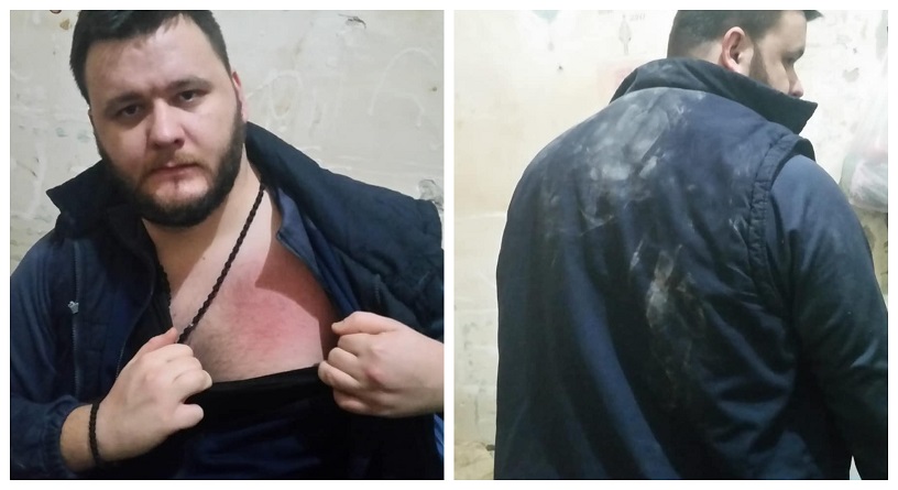 Investigation initiated in the prison beating of Cento