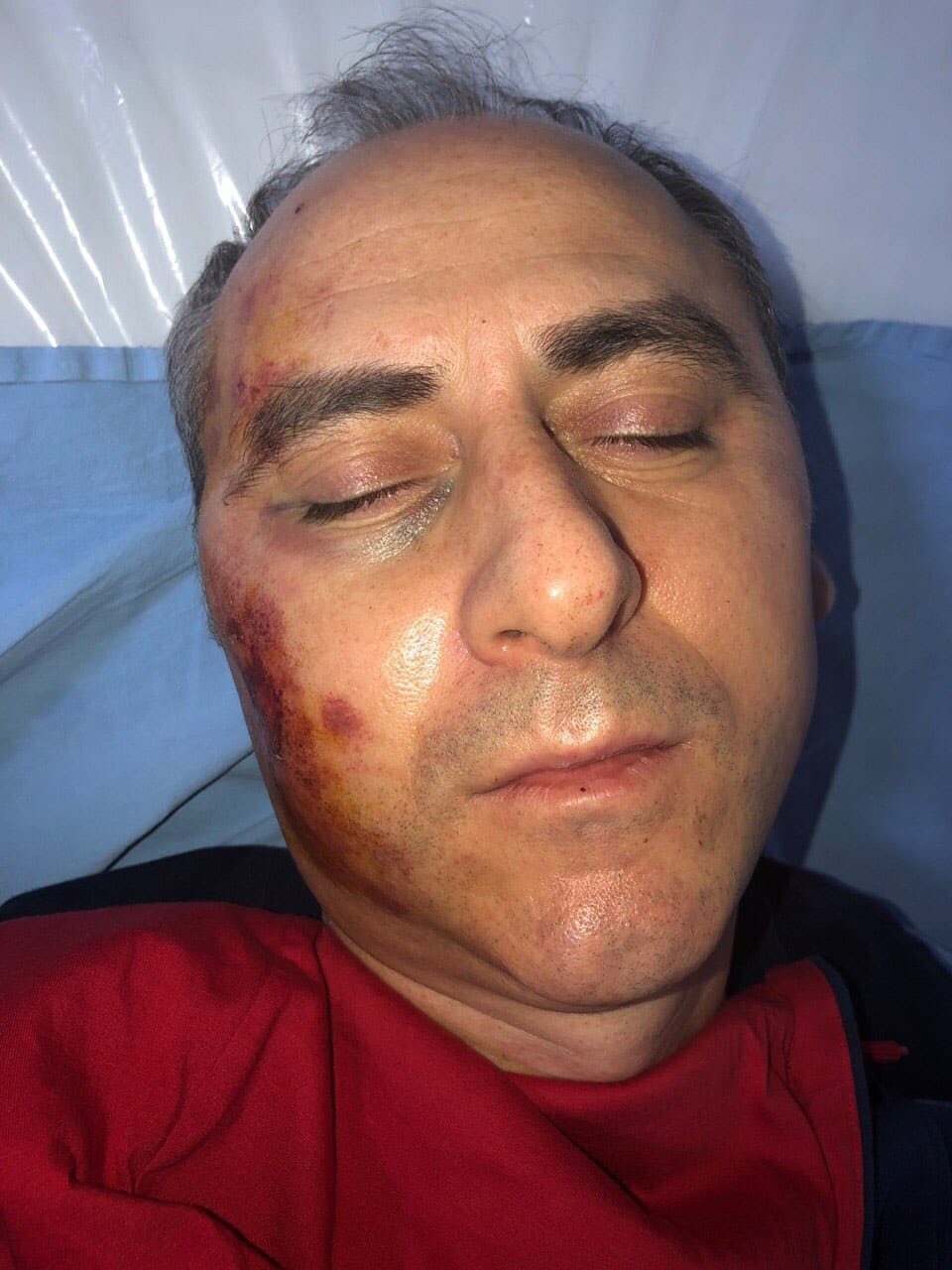 Persecuted former Mayor Toni Trajkovski sustained head injuries after being attacked by a group of thugs