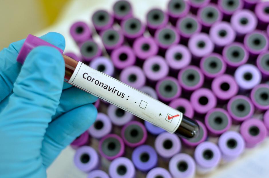 First coronavirus case in Macedonia