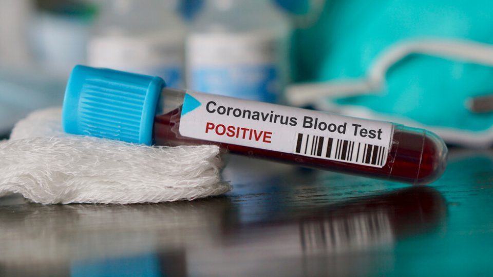 9 new coronavirus cases registered in the country – total number rises to 85