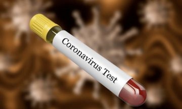 First coronavirus patient in Macedonia tests negative again