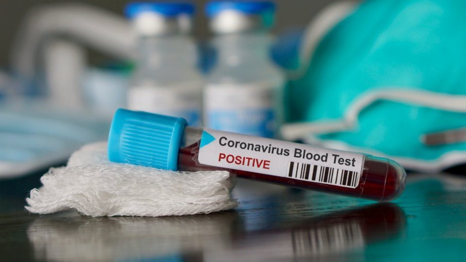 Potential coronavirus drug has failed in its first test