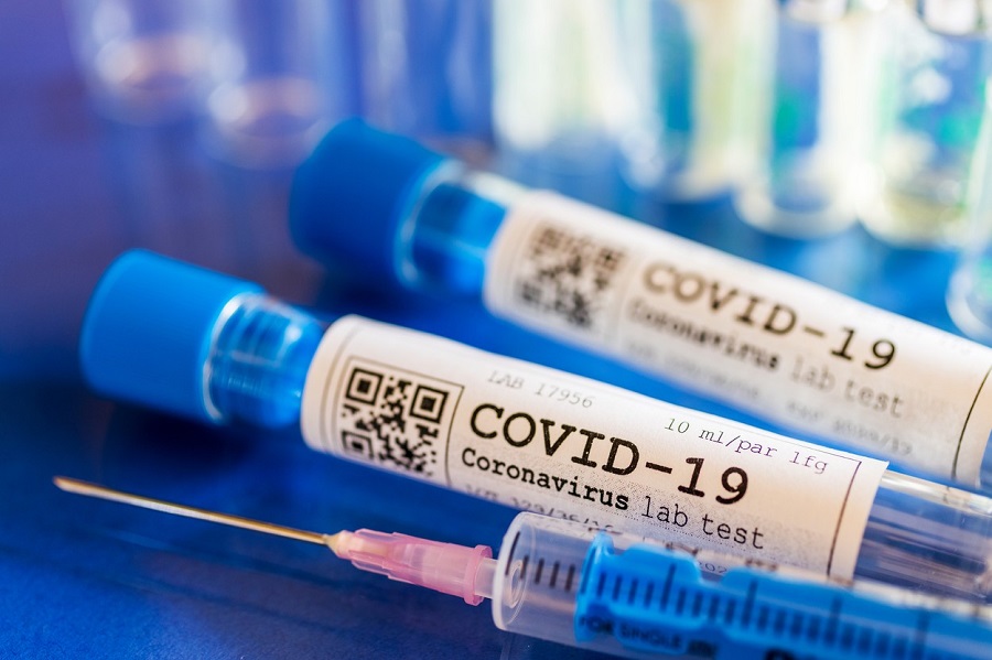 Two more labs to perform Covid-19 testing in Macedonia