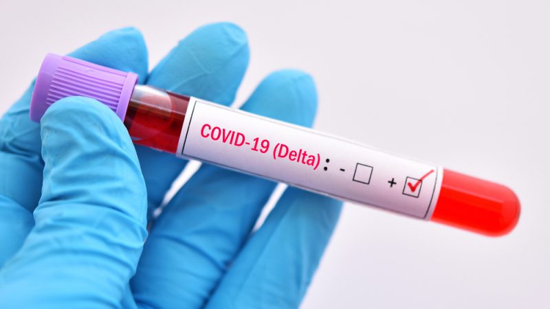 Weekly corona report: 522 citizens contracted the virus for a second time, five of them died