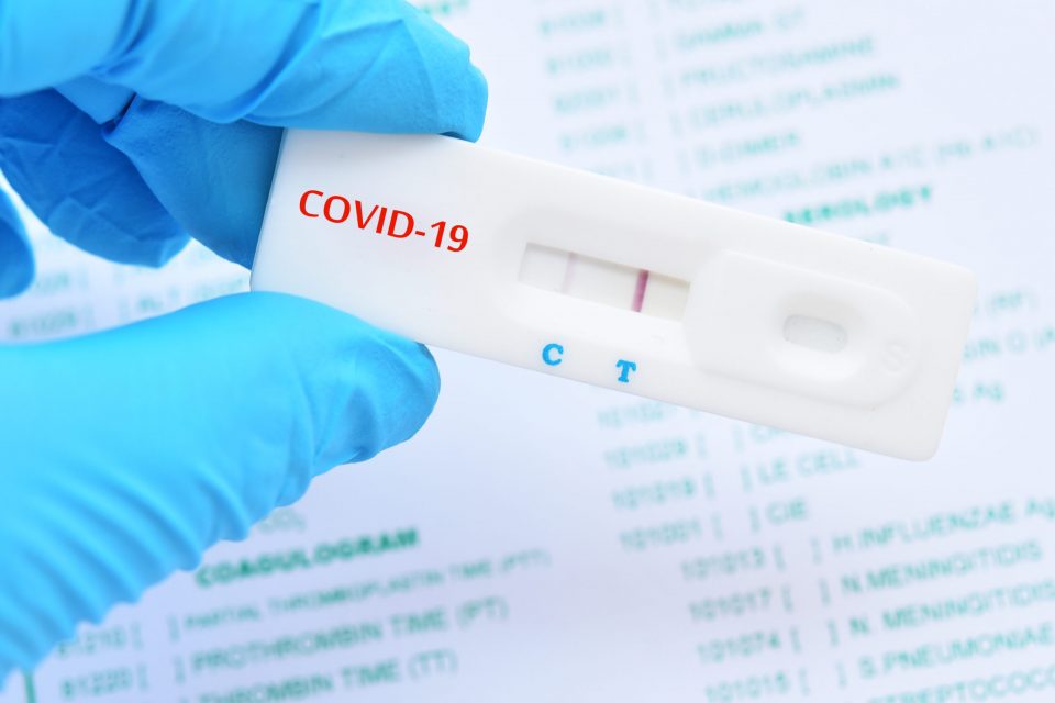 13 patients died, 318 new Covid-19 cases